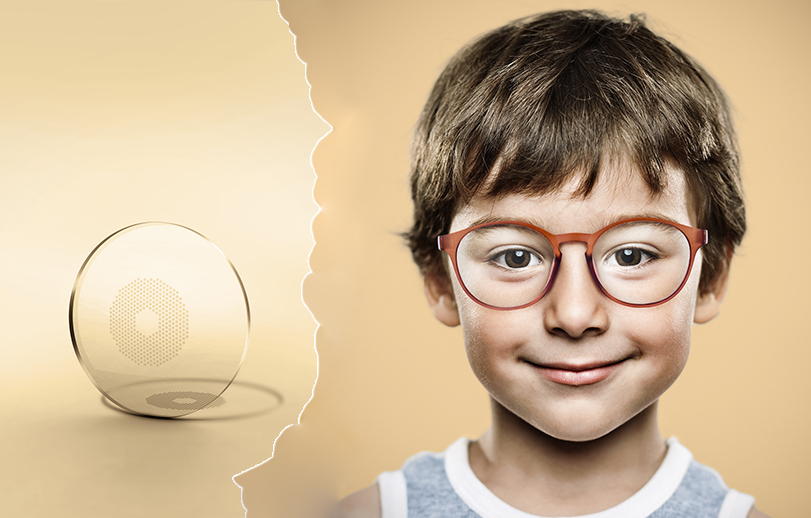 Innovatives Brillenglas bremst Kurzsichtigkeit